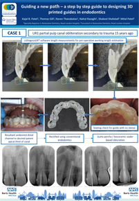 Case1